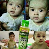 100ml Chicken Pox Measles Semambu Leaf Powder
